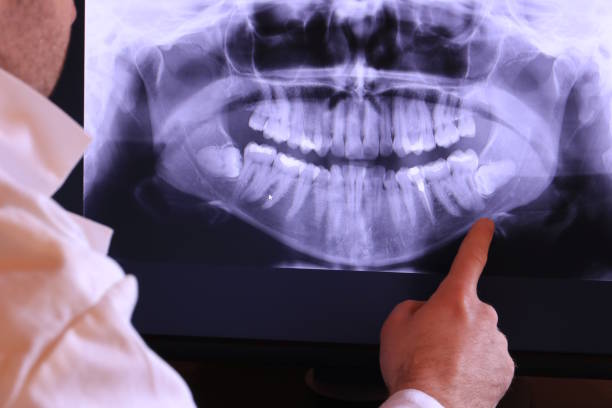 Best 24-Hour Emergency Dental Care in Big Le, AK